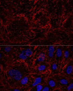 Septin-9 Antibody in Immunocytochemistry (ICC/IF)