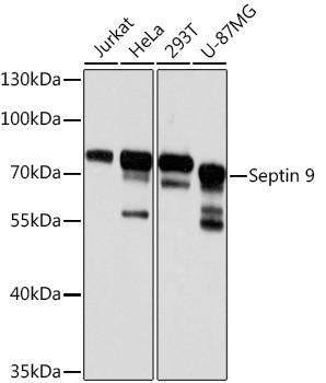 Septin-9 Antibody in Western Blot (WB)