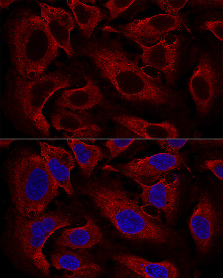 ARL8B Antibody in Immunocytochemistry (ICC/IF)