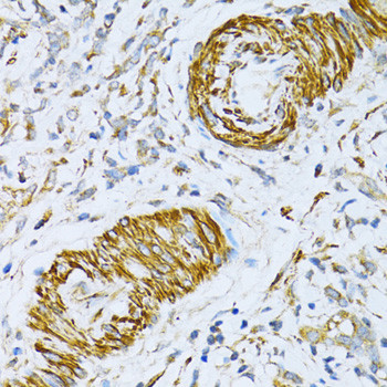 VAMP1 Antibody in Immunohistochemistry (Paraffin) (IHC (P))