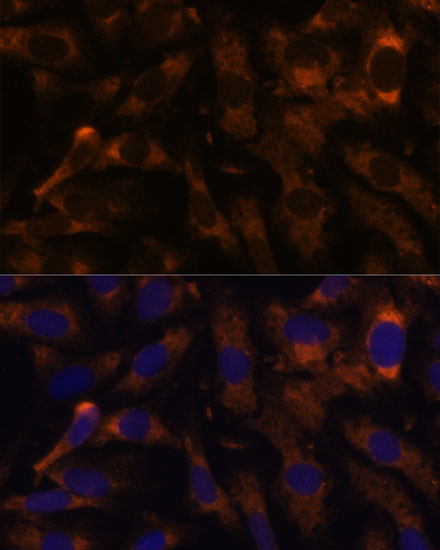 SUCLG2 Antibody in Immunocytochemistry (ICC/IF)