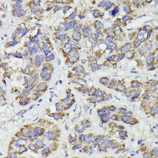 SUCLG2 Antibody in Immunohistochemistry (Paraffin) (IHC (P))