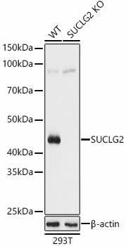 SUCLG2 Antibody in Western Blot (WB)