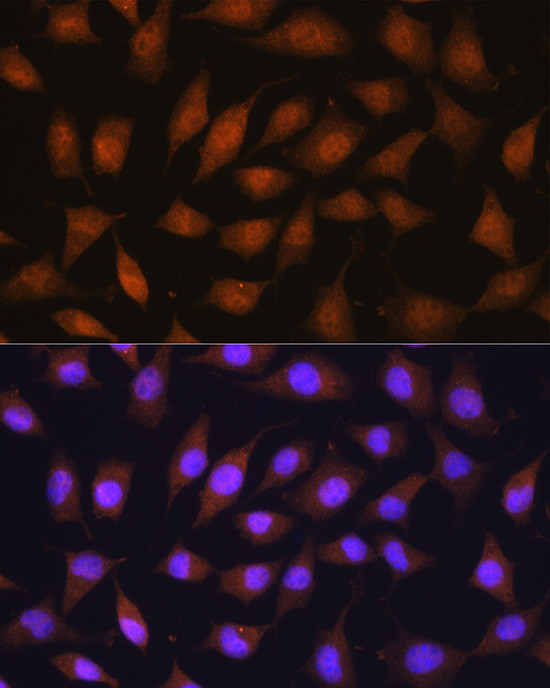 RPSA Antibody in Immunocytochemistry (ICC/IF)