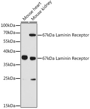 RPSA Antibody in Western Blot (WB)