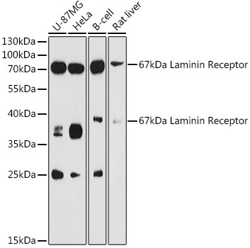 RPSA Antibody in Western Blot (WB)