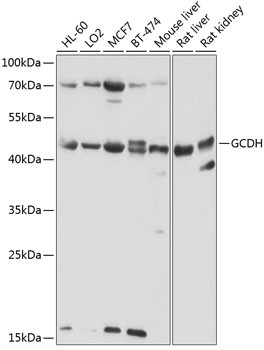 GCDH Antibody in Western Blot (WB)