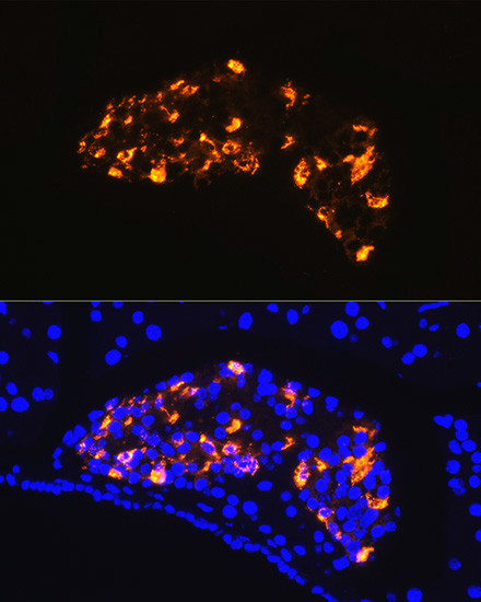 Somatostatin Antibody in Immunocytochemistry (ICC/IF)