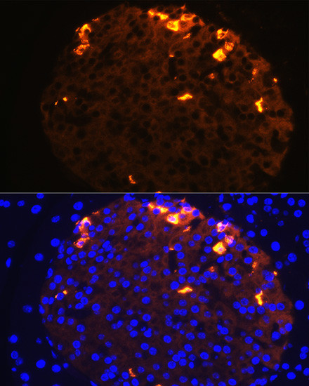 Somatostatin Antibody in Immunocytochemistry (ICC/IF)