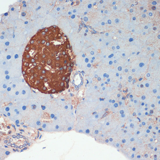 Somatostatin Antibody in Immunohistochemistry (Paraffin) (IHC (P))