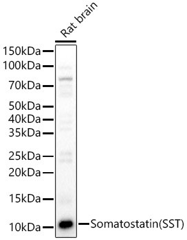 Somatostatin Antibody in Western Blot (WB)