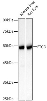 Golgi protein 58k Antibody in Western Blot (WB)