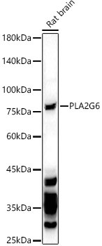 PLA2G6 Antibody in Western Blot (WB)