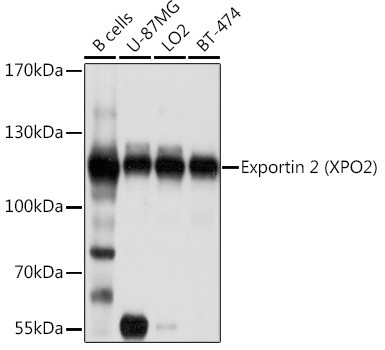 CAS Antibody in Western Blot (WB)