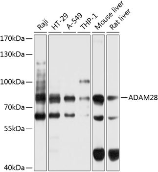 ADAM28 Antibody in Western Blot (WB)