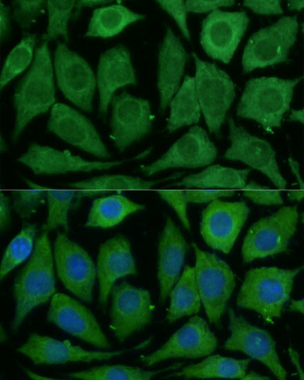 SARDH Antibody in Immunocytochemistry (ICC/IF)