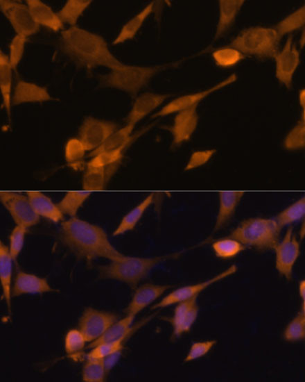 Ubiquilin 2 Antibody in Immunocytochemistry (ICC/IF)