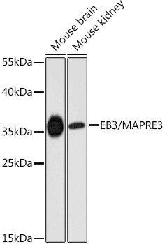 MAPRE3 Antibody in Western Blot (WB)