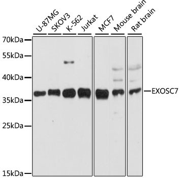 EXOSC7 Antibody in Western Blot (WB)