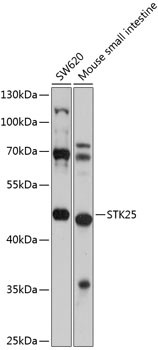 STK25 Antibody in Western Blot (WB)