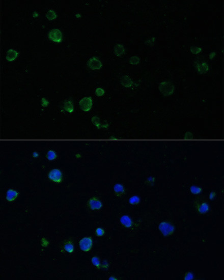 NOXA Antibody in Immunocytochemistry (ICC/IF)