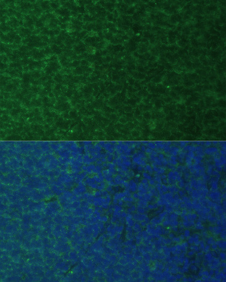 NOXA Antibody in Immunocytochemistry (ICC/IF)