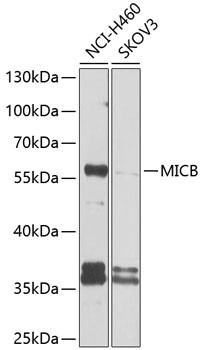 MICB Antibody in Western Blot (WB)