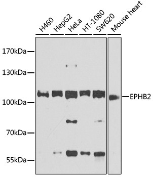 EphB2 Antibody in Western Blot (WB)