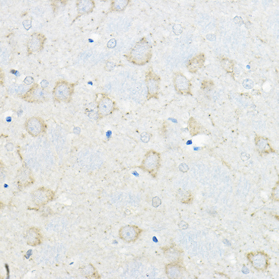 GIPR Antibody in Immunohistochemistry (Paraffin) (IHC (P))