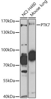 PTK7 Antibody in Western Blot (WB)