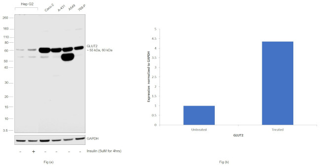 GLUT2 Antibody in Western Blot (WB)