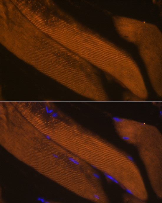 FBP2 Antibody in Immunohistochemistry (Paraffin) (IHC (P))