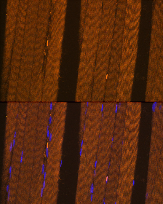 FBP2 Antibody in Immunohistochemistry (Paraffin) (IHC (P))