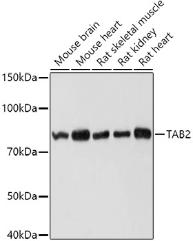 Tab2 Antibody in Western Blot (WB)