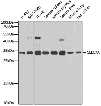 Dectin-1 Antibody in Western Blot (WB)