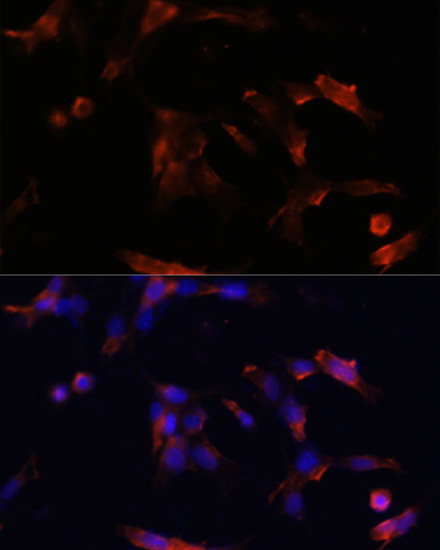 Aquaporin 5 Antibody in Immunocytochemistry (ICC/IF)