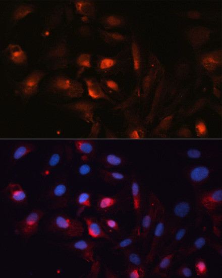 Aquaporin 5 Antibody in Immunocytochemistry (ICC/IF)