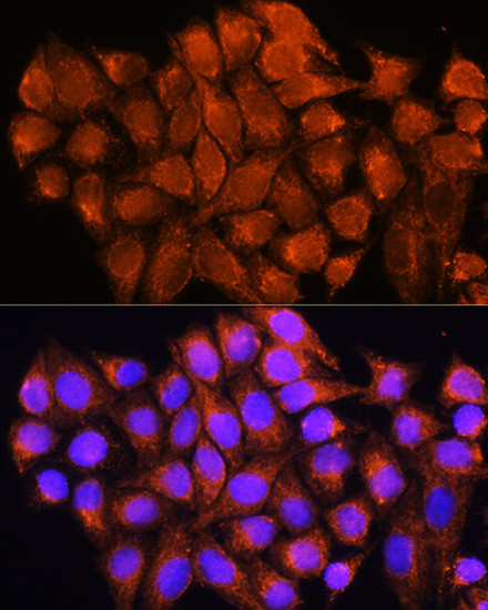 ATP5D Antibody in Immunocytochemistry (ICC/IF)