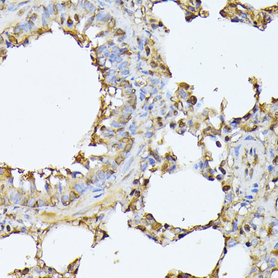 PSMB3 Antibody in Immunohistochemistry (Paraffin) (IHC (P))