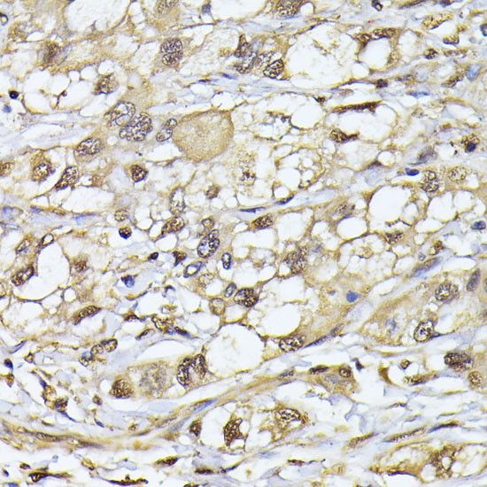 PSMB3 Antibody in Immunohistochemistry (Paraffin) (IHC (P))