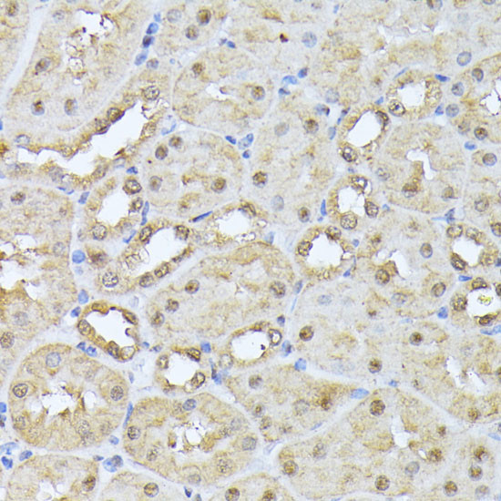 PSMB3 Antibody in Immunohistochemistry (Paraffin) (IHC (P))