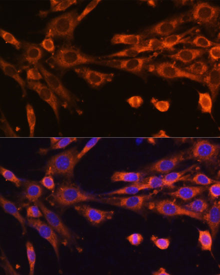 SUPV3L1 Antibody in Immunocytochemistry (ICC/IF)