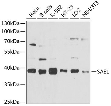 SAE1 Antibody in Western Blot (WB)