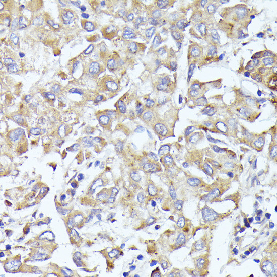 eIF3l Antibody in Immunohistochemistry (Paraffin) (IHC (P))