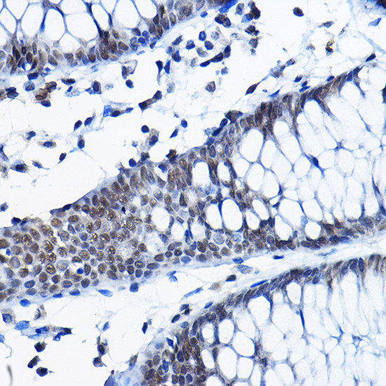 RPP25 Antibody in Immunohistochemistry (Paraffin) (IHC (P))