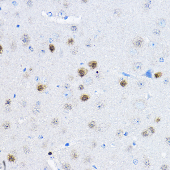 RPP25 Antibody in Immunohistochemistry (Paraffin) (IHC (P))