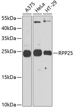 RPP25 Antibody in Western Blot (WB)