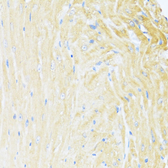 MNF1 Antibody in Immunohistochemistry (Paraffin) (IHC (P))