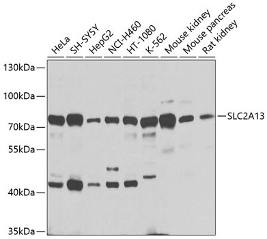 SLC2A13 Antibody in Western Blot (WB)