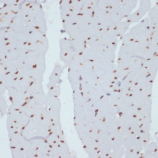 Phospho-Chk1 (Ser280) Antibody in Immunohistochemistry (Paraffin) (IHC (P))